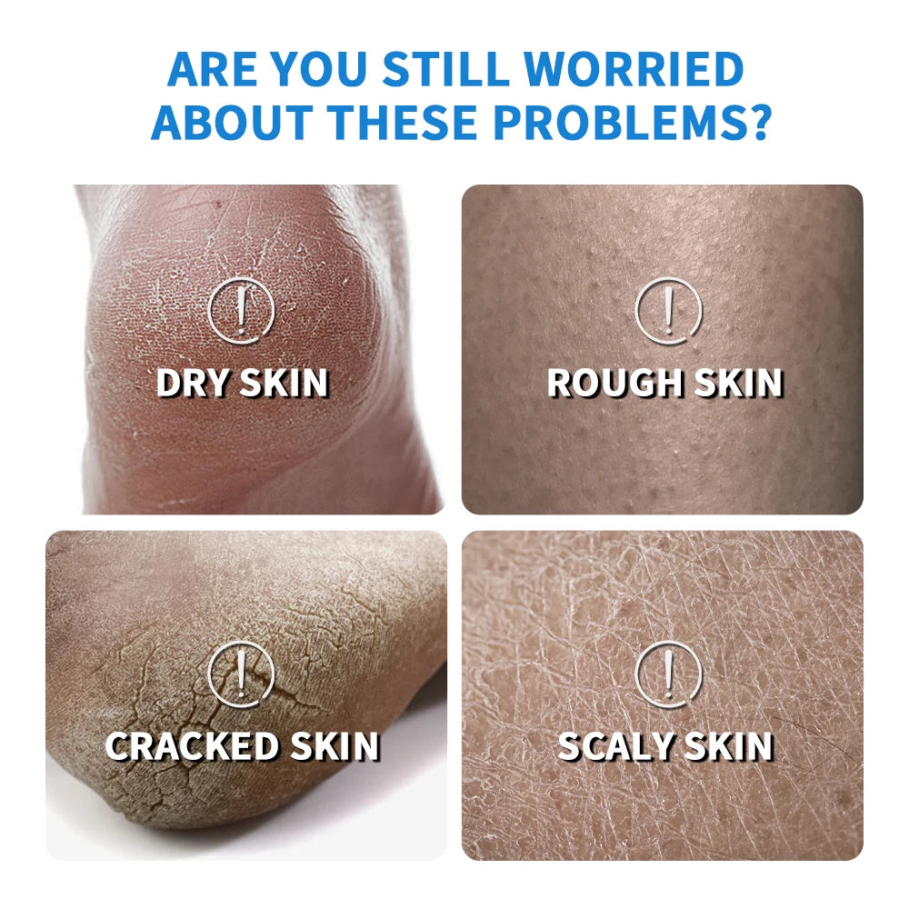 New 42% Urea Cream + 2% Salicylic acid Foot and hand Moisturizer, deep moisturizer and Nourishing moisturizer Oasis Select