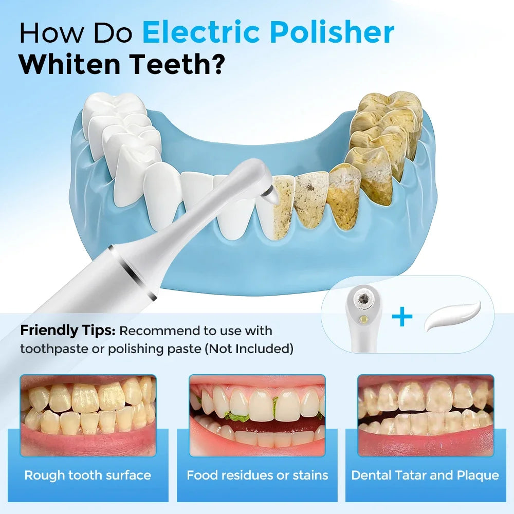 Electric Tooth Polisher – 5 Modes, 6 Heads, LED Light