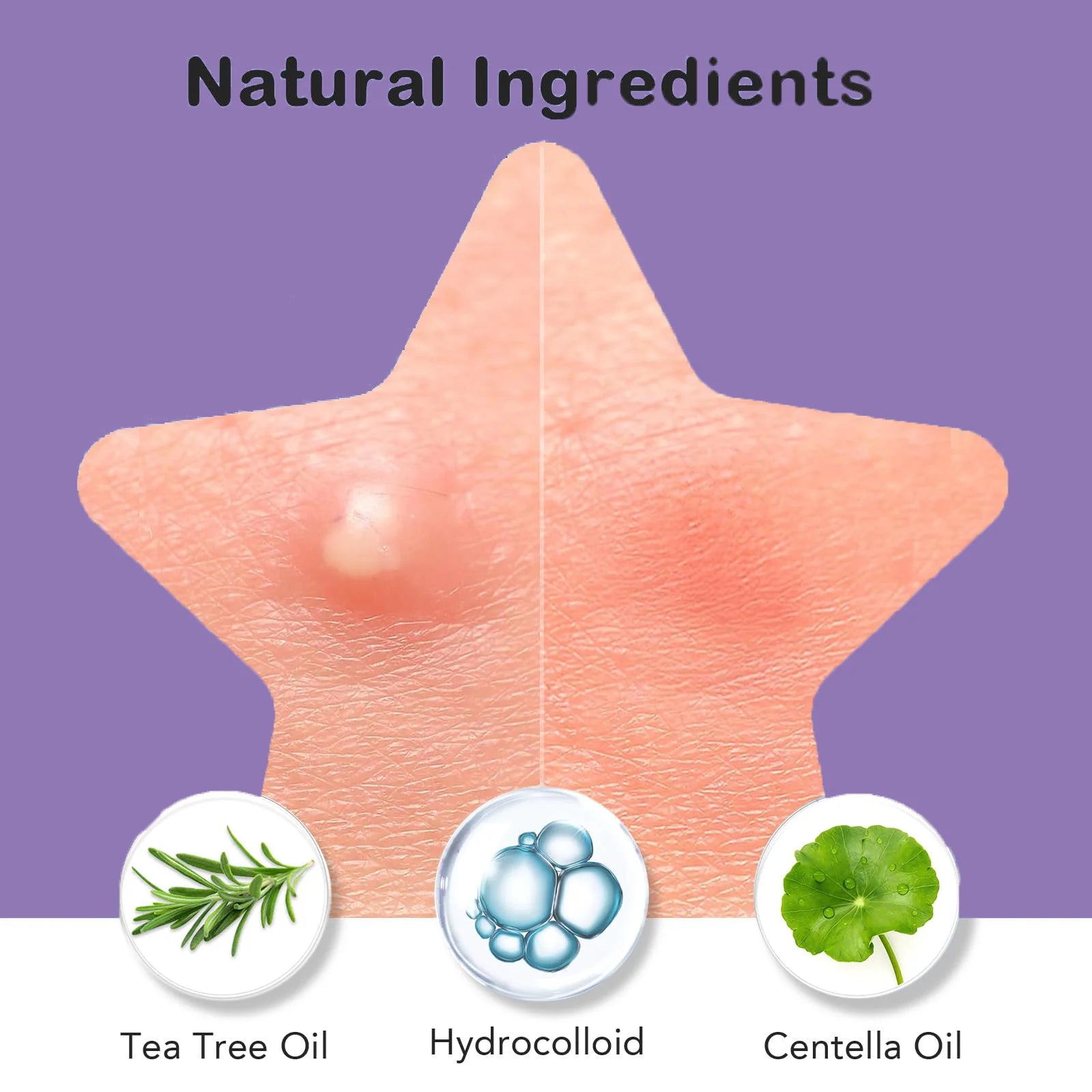 18/9pcs Water Colloidal Pink Heart shaped Micro Needle Acne Patch - Waterproof, Alcohol Free, Used to Absorb Acne Secretions Oasis Select
