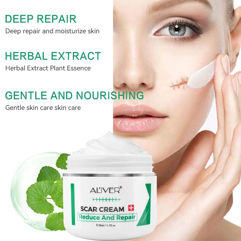 ALVER Acne Scar Stretch Marks Remover Cream Skin Repair Acne Black Dots Spots Acne Treatment Blackhead Bleaching Cream 50ml Oasis Select