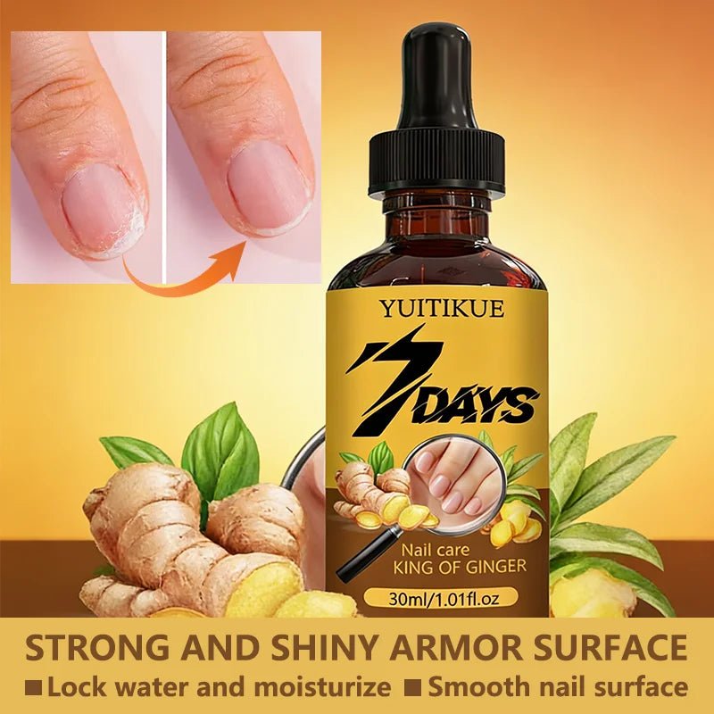 YUITIKUE 7Days Ginger Nail Care Oil - Nourish & Strengthen Nails, Dropper Design for Shiny, Healthy Nails 30ml Oasis Select