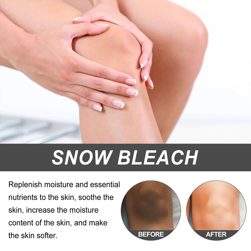 Dark Spot Brightening Cream – Underarms, Thighs & Joints Skin Brightening Cream Oasis Select