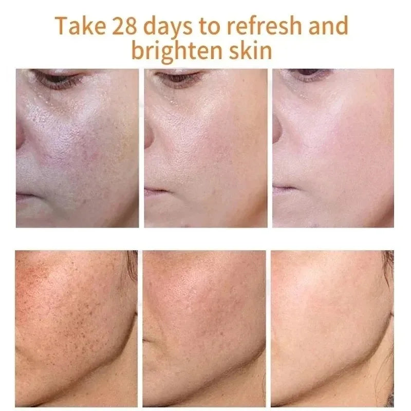 Fades Freckle Dark Spots Face Cream Niacinamide Whitening Cream Vitamin E Improve Dullness Fast Brighten Nourish Skin Care Oasis Select