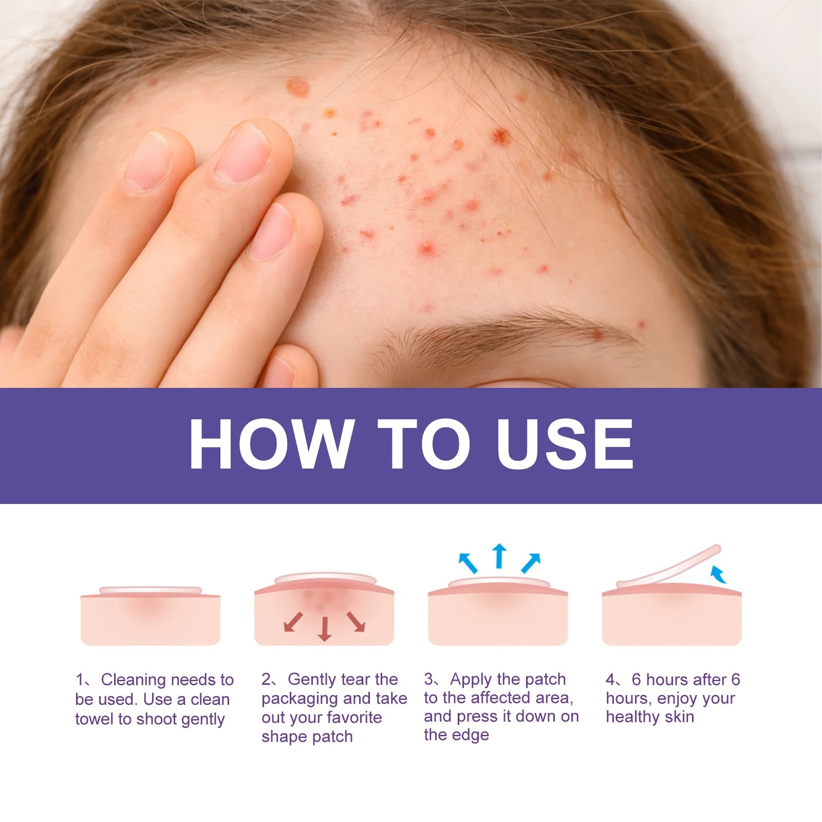 Pimple Patch Invisible Clear Facial Acne Patch Covering Acne and Blemishes Cloud Circle Moon Stars Love Shaped Pimples Patches Oasis Select