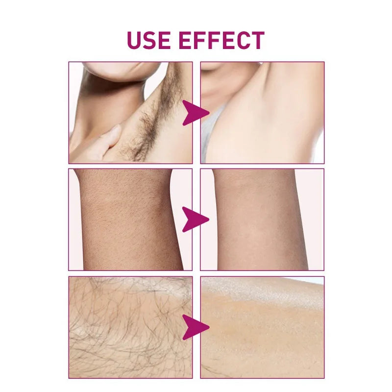 OceAura Hair Removal Cream & Growth Inhibitor 100ml
