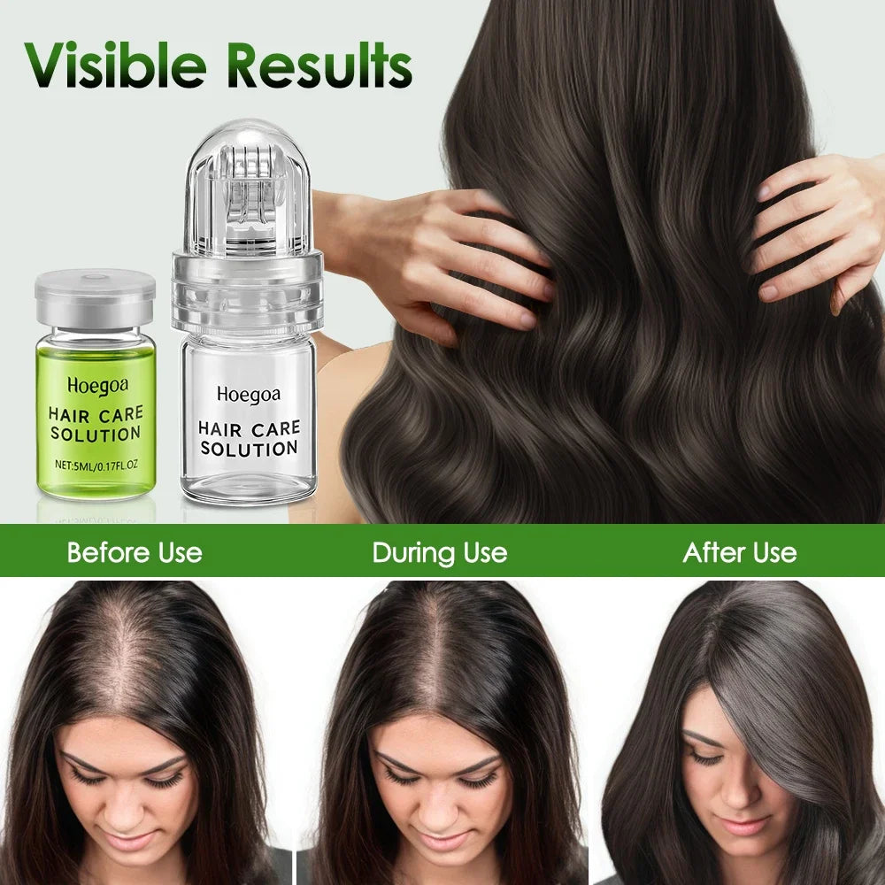 Hailicare Hair Growth Serum – Strengthen Roots & Reduce Loss Hair Growth Serum Oasis Select