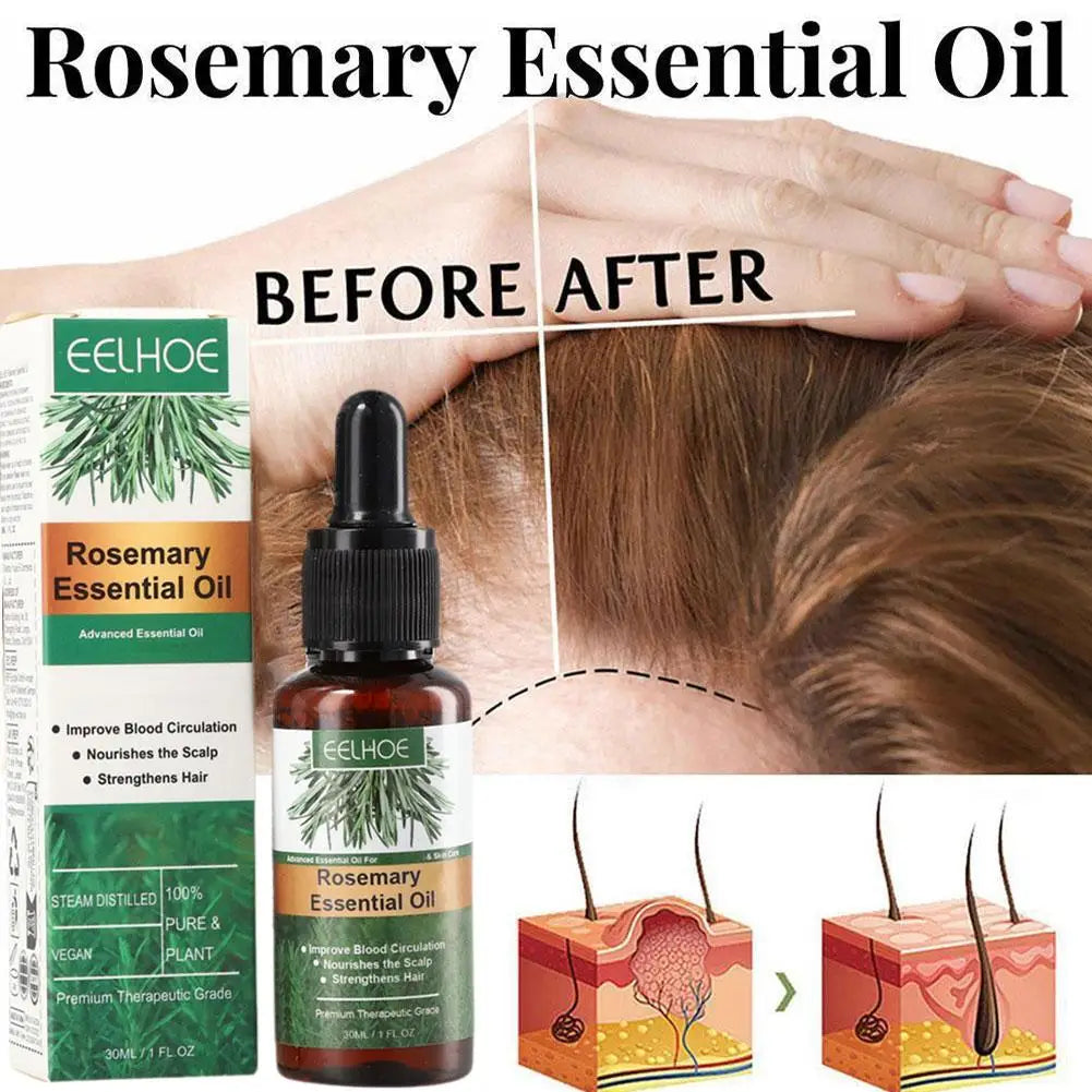 Eelhoe Rosemary Oil for Hair Growth & Repair – 30ml