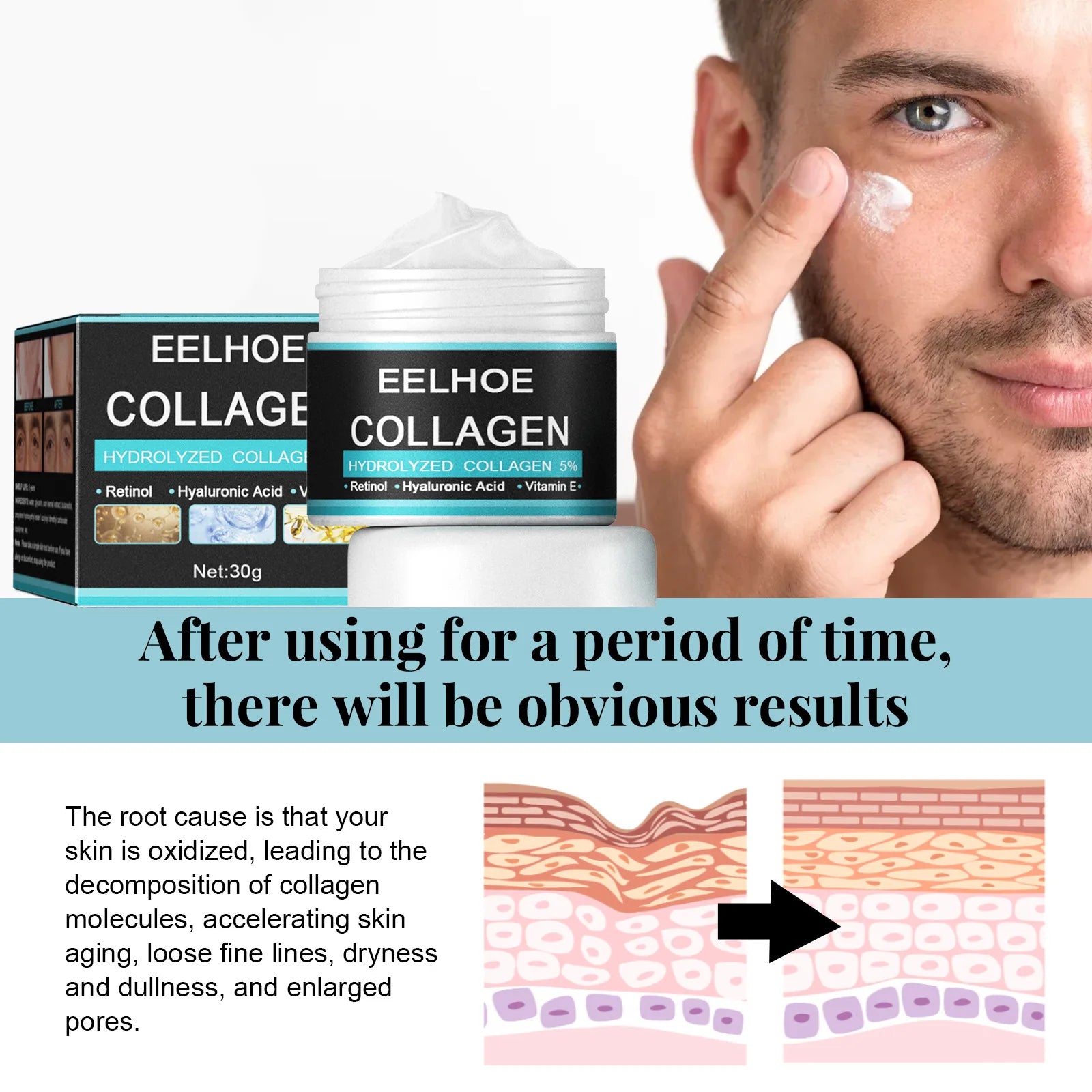 EELHOE Vitamin E Moisturizing Cream Man Improve Rough Dry Skin Tightening Nourishing Retinol Rejuvenate the Face Cream Man 50g Oasis Select
