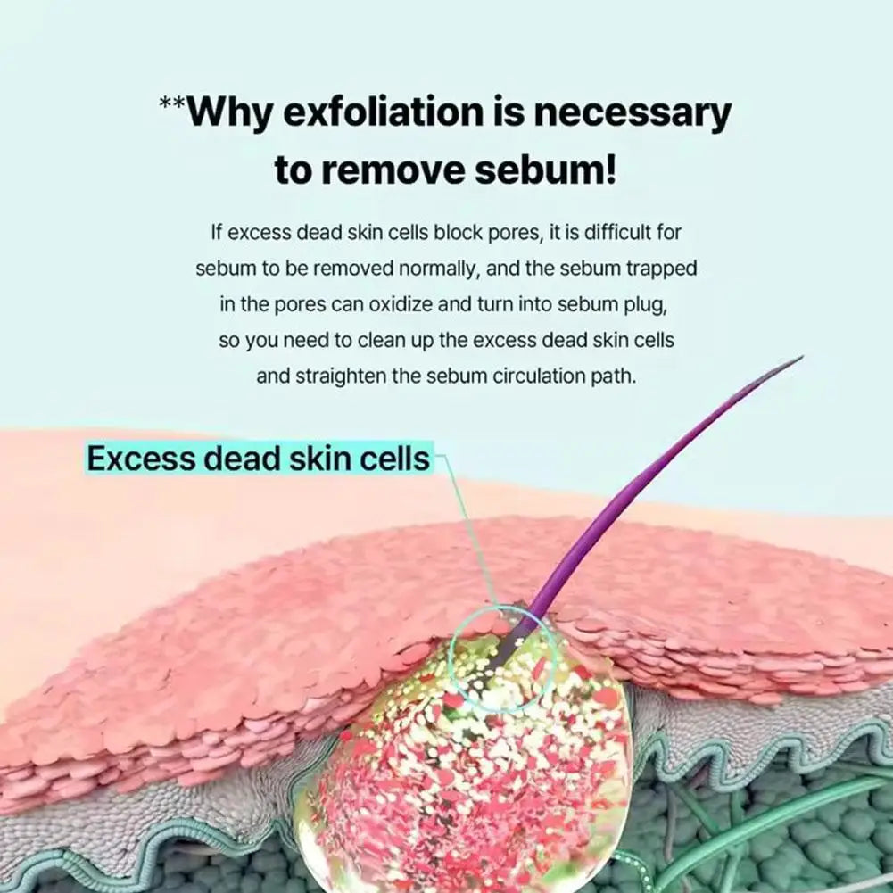 150ML Koorean Blackhead Extractor Toner Super Melting Sebum Softener Stronger Blackhead Cleansing ilso Moisturizing Facial Care Oasis Select