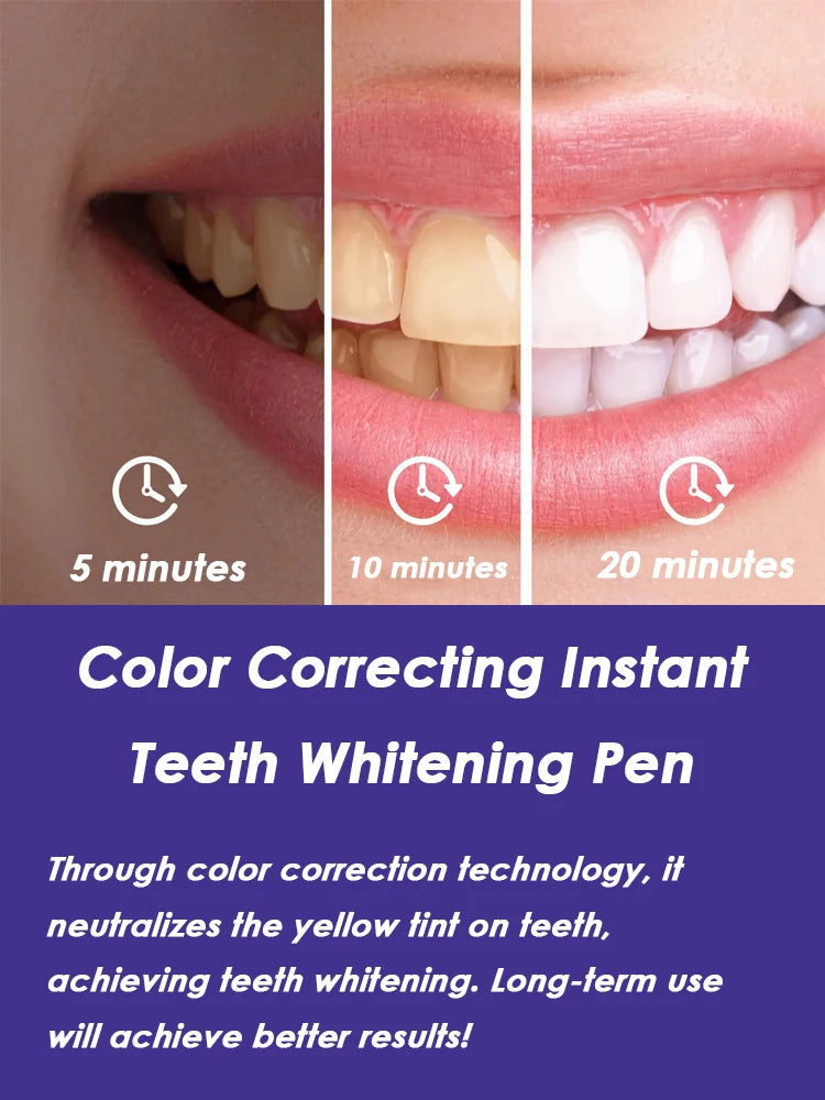 Purple Instant Teeth Whitening Pen Tartar Toothpaste Cleaning Tooth Stain No Sensitivity for a Brighter Whiter Smile Decay Care Oasis Select