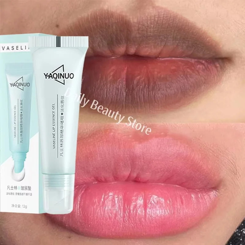 Remove Dark Lip Balm Fast Lightening Pink Lip Exfoliating Fade Lip Line Dead Skin Moisturizer Korean Care Products Beauty Health Oasis Select