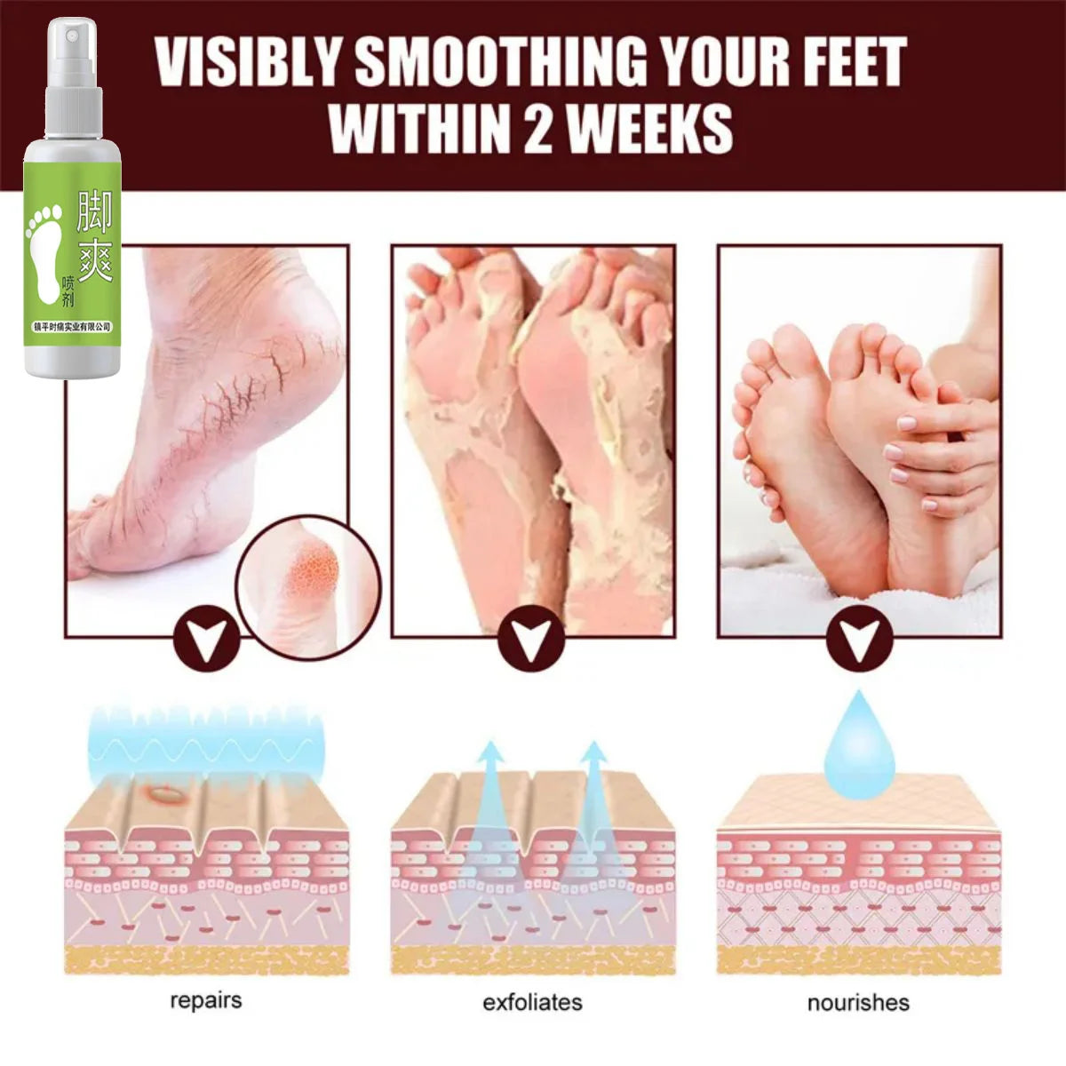 Anti Beriberi Spray Essential Oils Essence Odor Destroy Agent Care Products Feet Deodorant Spray Oasis Select