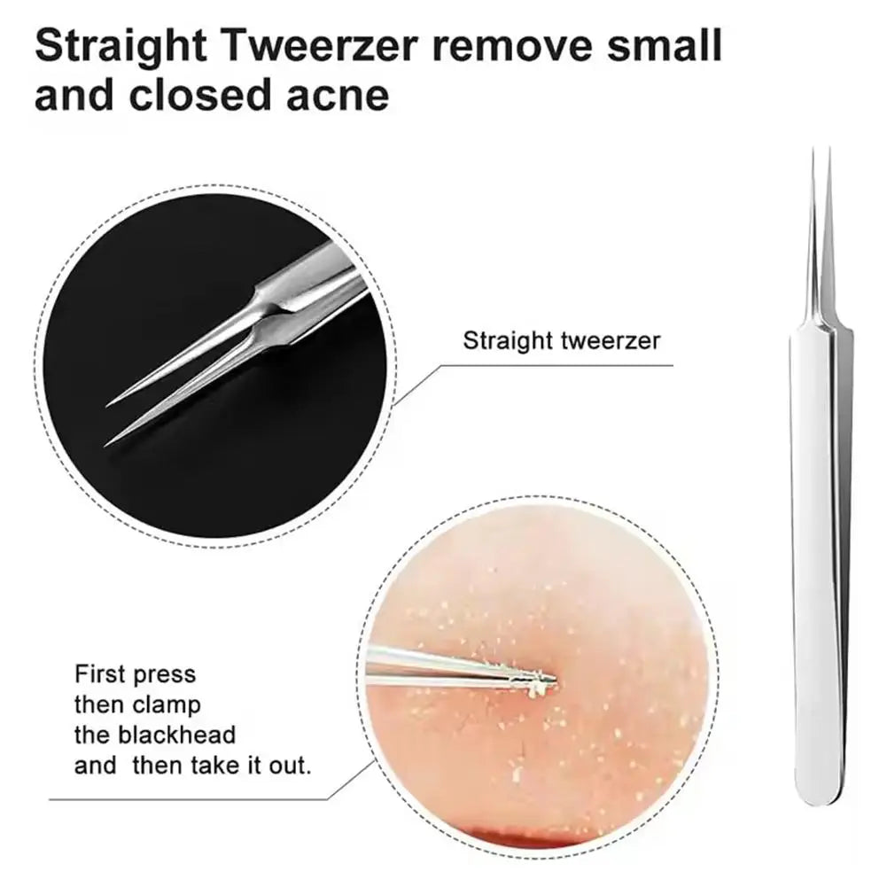 3PCS/kit Acne Needle Blackhead Clip Remover Extraction Pore Black Head Clean Face Skin Care Cleansing Needle Blemish Pick Tool Oasis Select