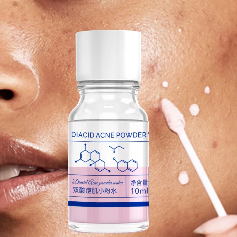 Salicylic & Lactic Acid Acne Face Serum with Calamine 10ml