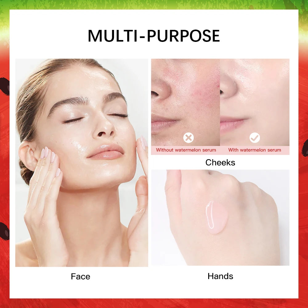 New Watermelon nicotinamide Light Bulb Essence Moisturizing Skin Brightening Face Brightening Essence For Women Skin Care Oasis Select