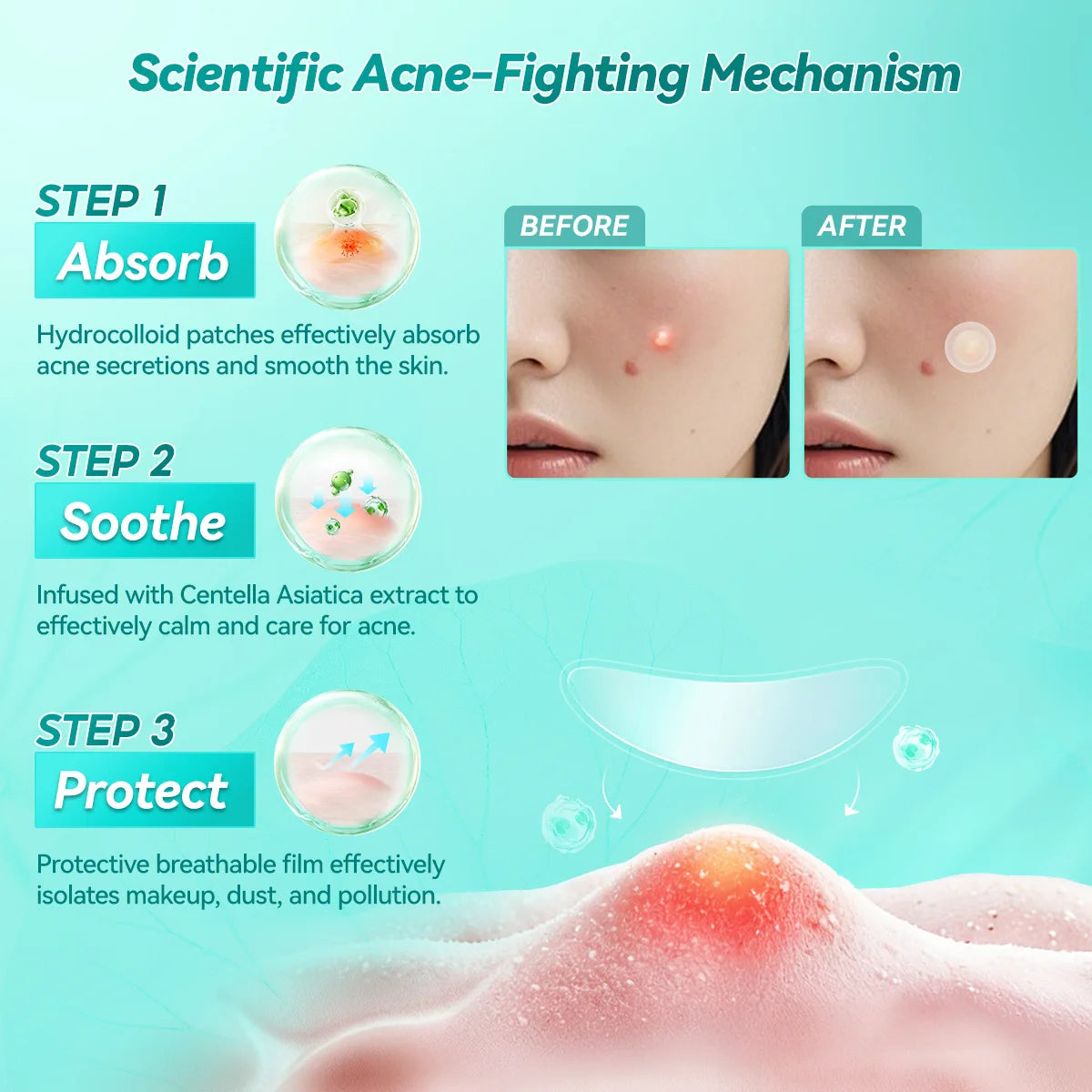 LANBENA Acne Pimple Patch Daily Use Invisible Acne Stickers Blemish Treatment Acne Concealer Makeup Oasis Select