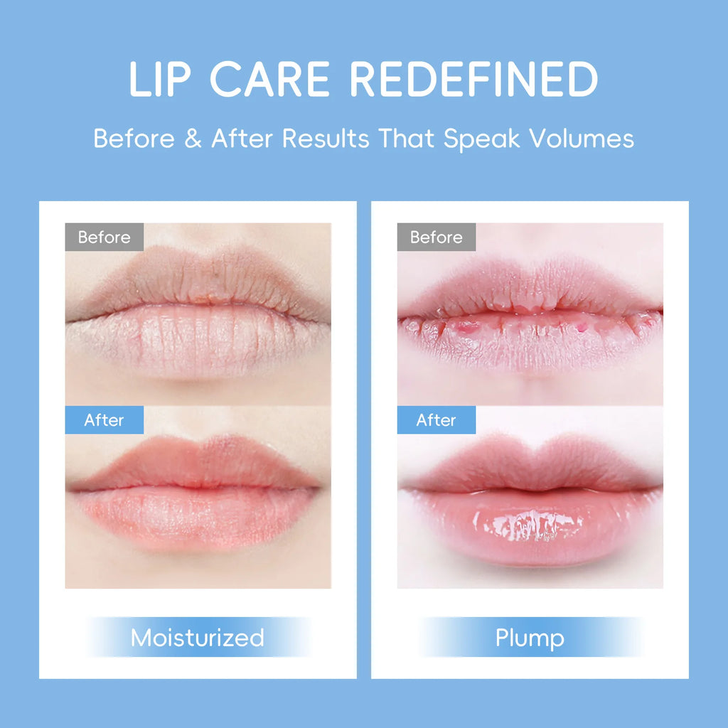 LAIKOU Milk Collagen Lip Mask – Hydrating & Line Repair Collagen Lip Mask Oasis Select