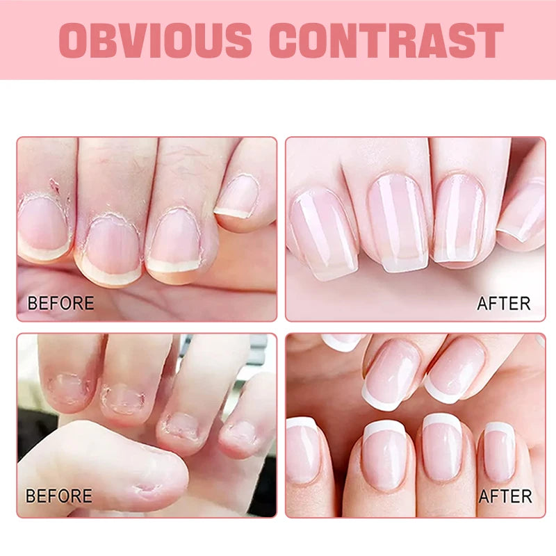 Nail & Cuticle Oil – Moisturizing, Strengthening & Hydrating Cuticle & Nail Oil Oasis Select