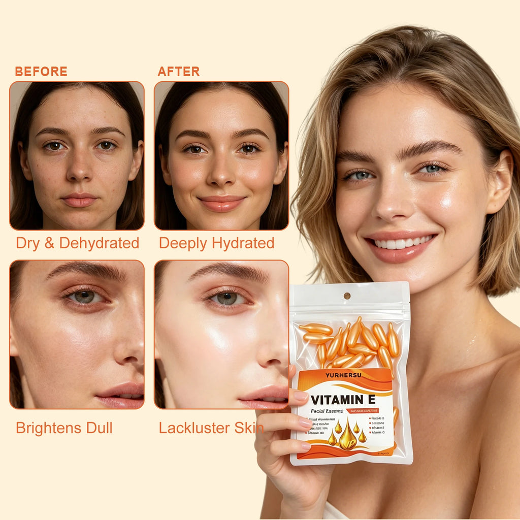 Vitamin E Essence Capsules – Deep Moisturizing Facial Serum Facial Essence Serum Oasis Select