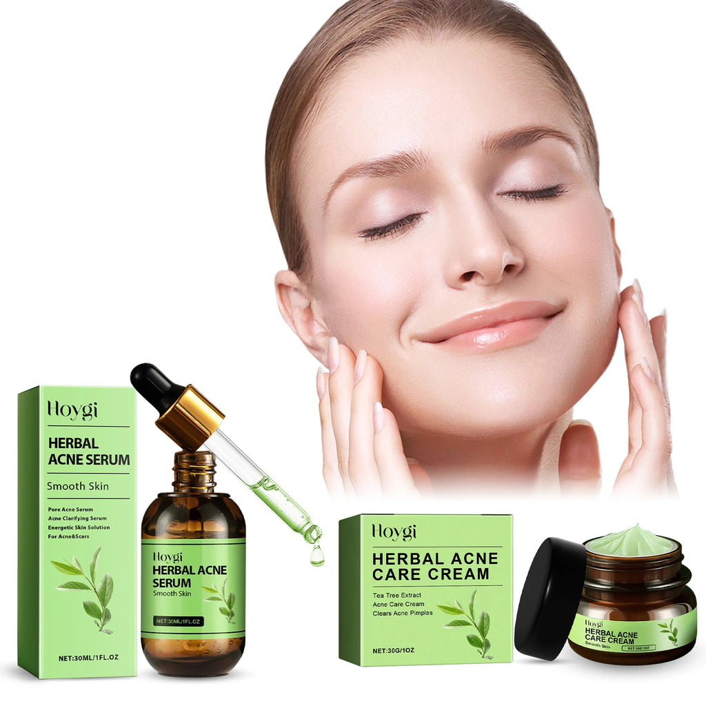 Hoygi Acne Face Cream – Salicylic Acid Pore Serum