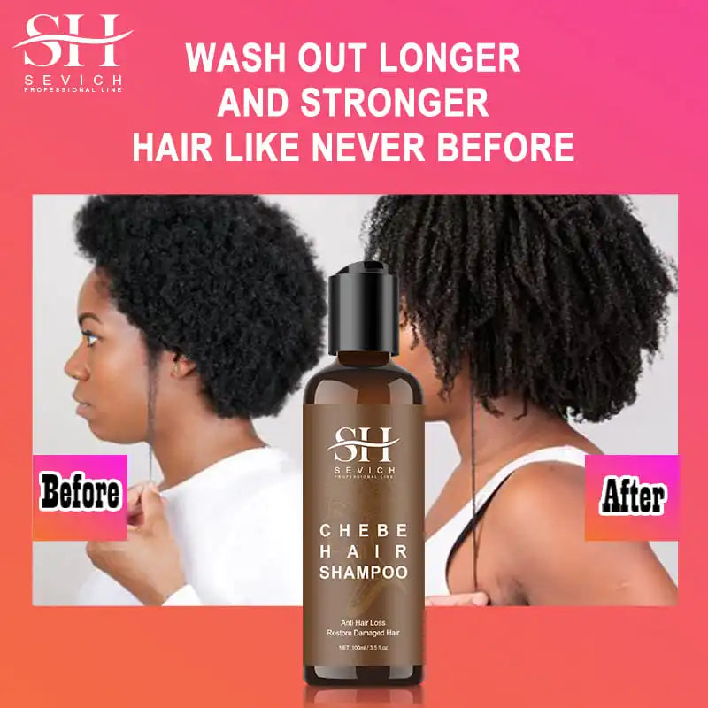 SEVICH Chebe Hair Growth Shampoo & Conditioner Set | Anti Hair Loss Hair Growth Shampoo Set Oasis Select