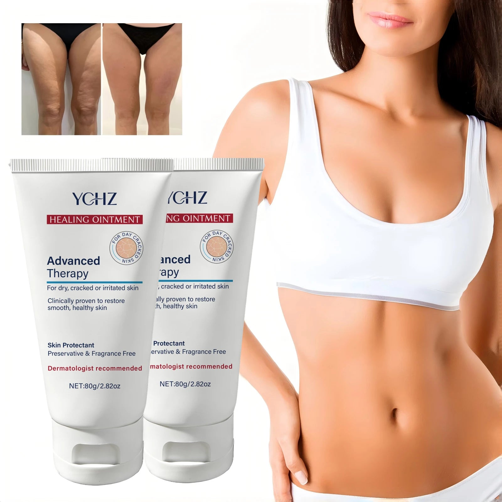 YCHZ Hydrating Body Cream – Shea Butter, Vitamin E & Hyaluronic Acid