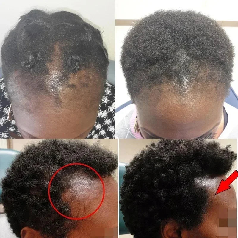 Batana Hair Growth Oil Conditioner Anti Hair Loss Products Fast Growing Hair Mask Nourishing Repair Roots Hair Care for women Oasis Select