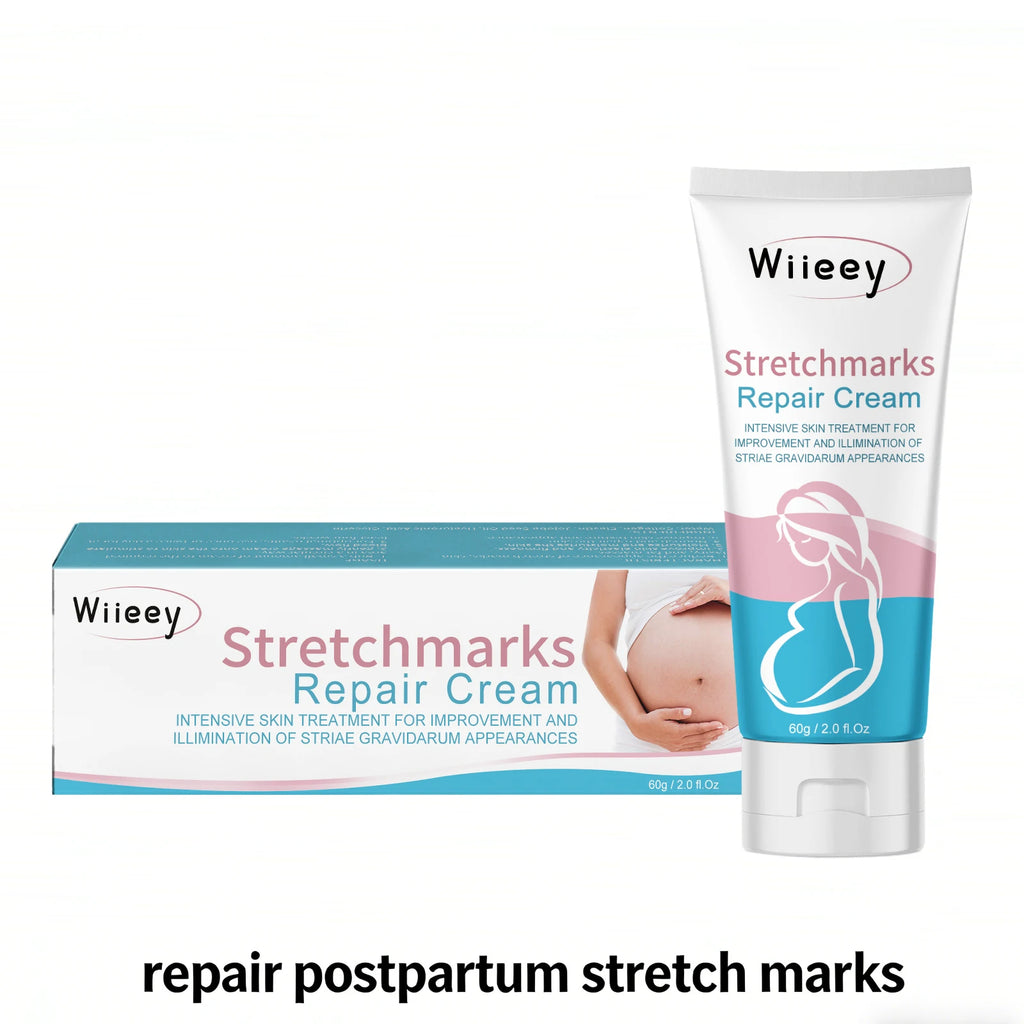 Stretch Mark Repair Cream – Firm, Moisturize & Restore Skin Stretch Mark Cream Oasis Select