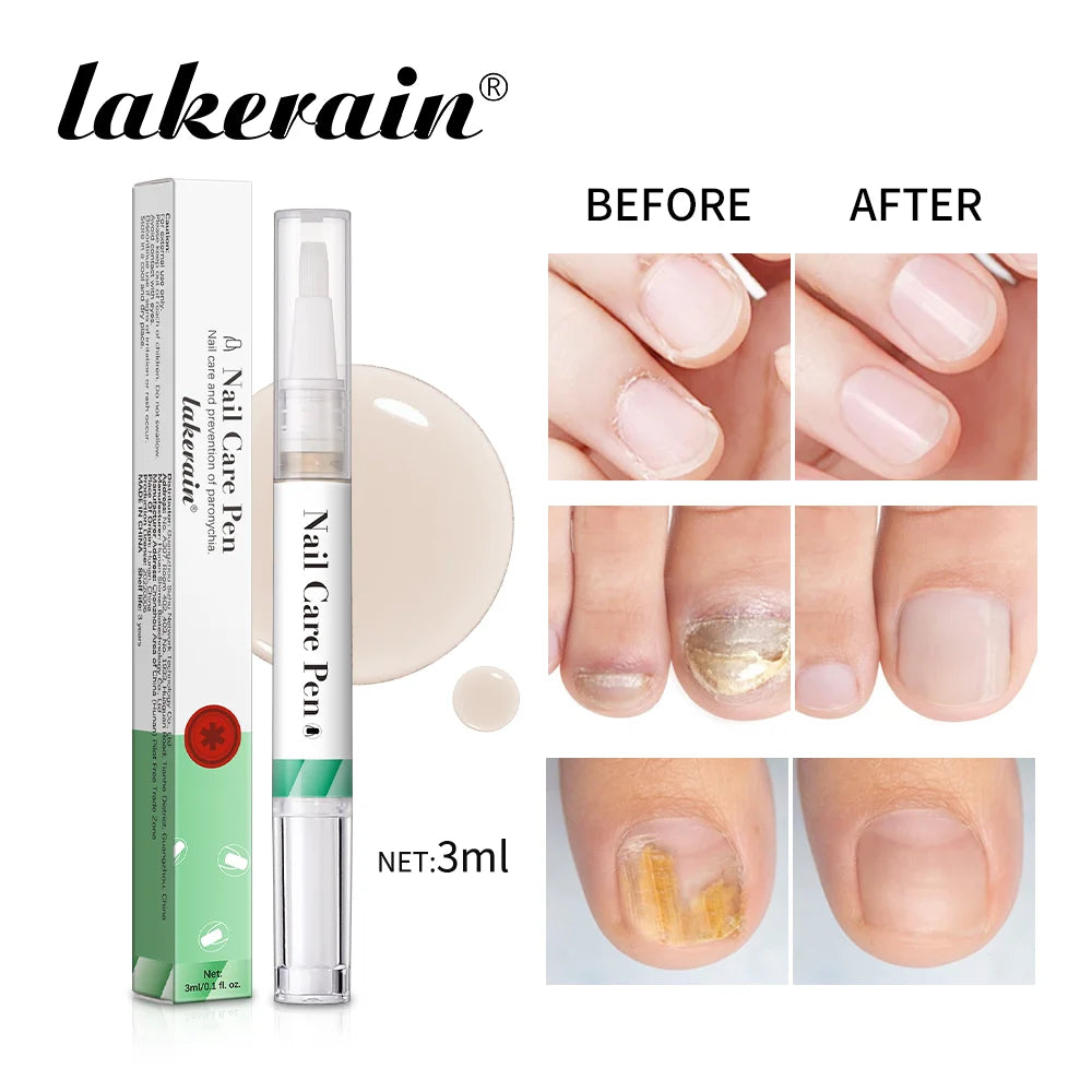 Nail Care Pen Nourish and Moisturize Nails Prevent Fungal Infections Improve Appearance Flat Brush Head Design Daily Nail Care Oasis Select