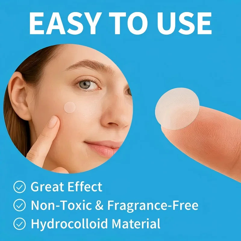 180/360 patches, invisible masking stickers for acne and blemishes - alcohol free, fragrance free, suitable for all skin types Oasis Select