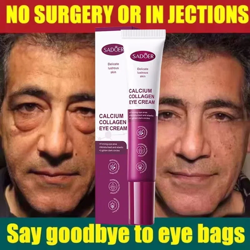 Instant Eye Bag Remove Eye Cream Anti Fat Particles Dark Circles Puffiness Fade Fine Lines Lift Brighten Korean Beauty Eye Care Oasis Select