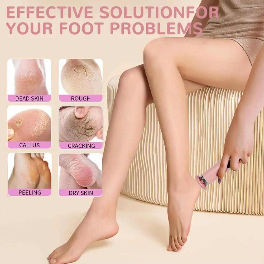 Electric Foot Callus Remover – 6-Speed Pedicure File & Grinder Electric Callus Remover Oasis Select