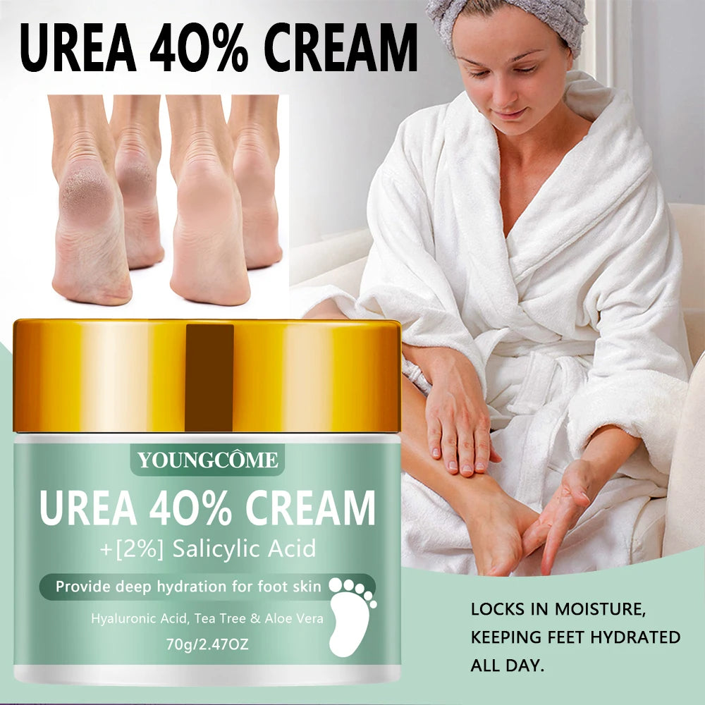 Urea 40% Foot & Hand Cream – Callus Softener | YOUNGCOME