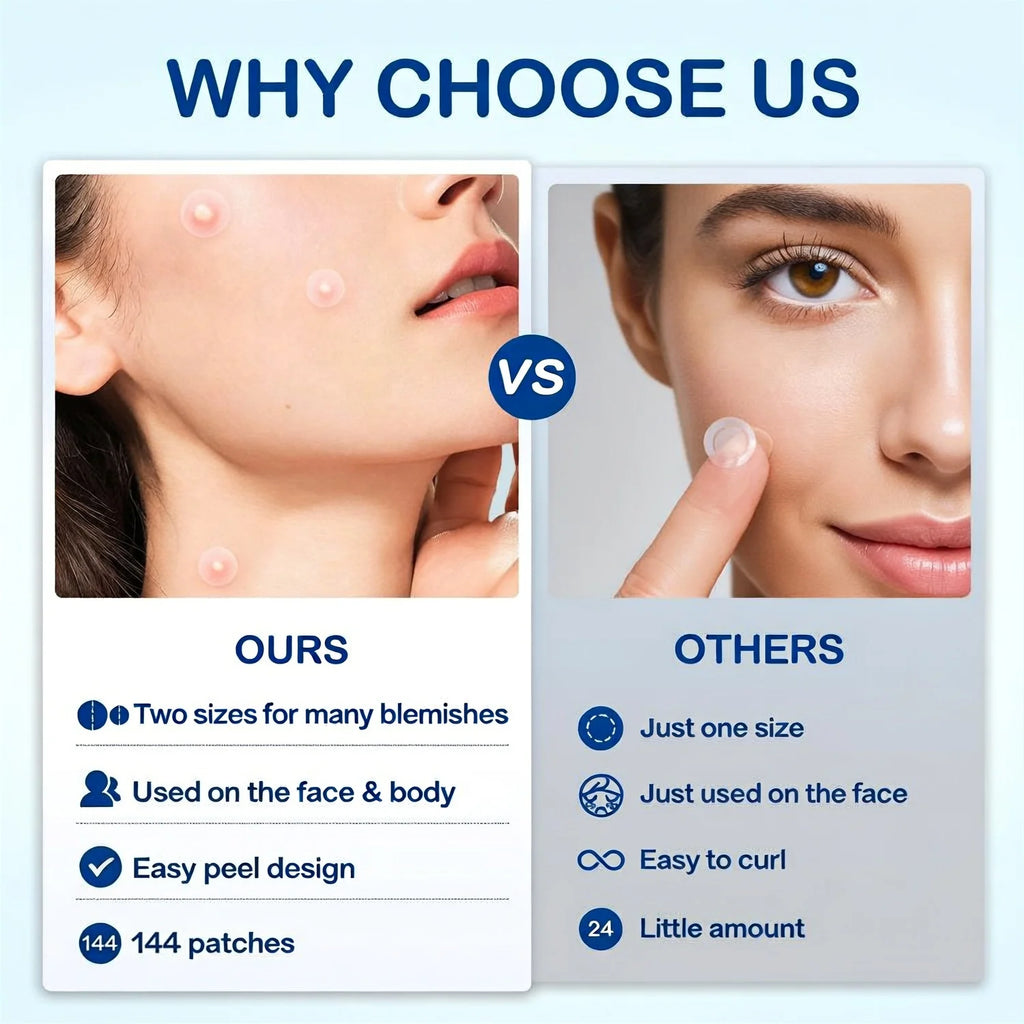 144 pieces of skin cleansing care patches, water-based gel with no irritation, suitable for all skin types. Hydrating acne patch Oasis Select