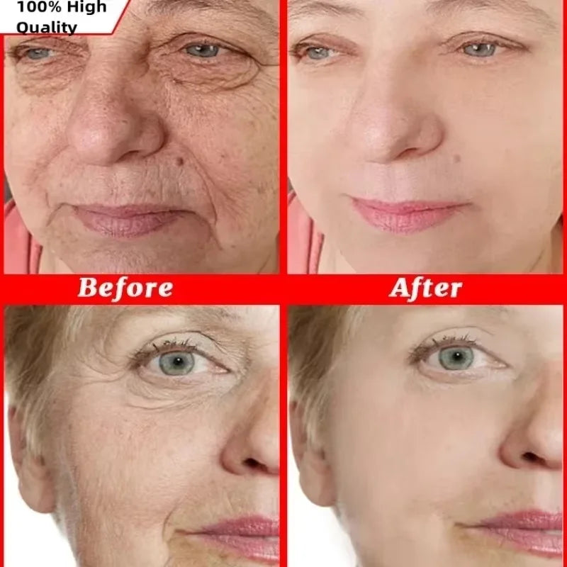 20-Pack Hyaluronic Acid Capsule Serum – Anti-Aging & Brightening Face Serum Capsules Oasis Select