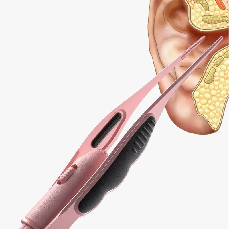 LED Ear Wax Removal Tweezers – Safe Tip for Kids & Adults
