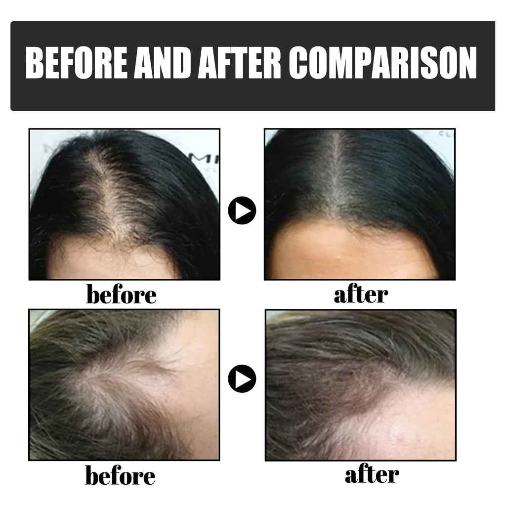 EELHOE Dense Hair Fiber Increase Hair Loss Concealer Instant Hair Shading Powder Hairline Enhancement Hairline Shadow Powder 12g Oasis Select