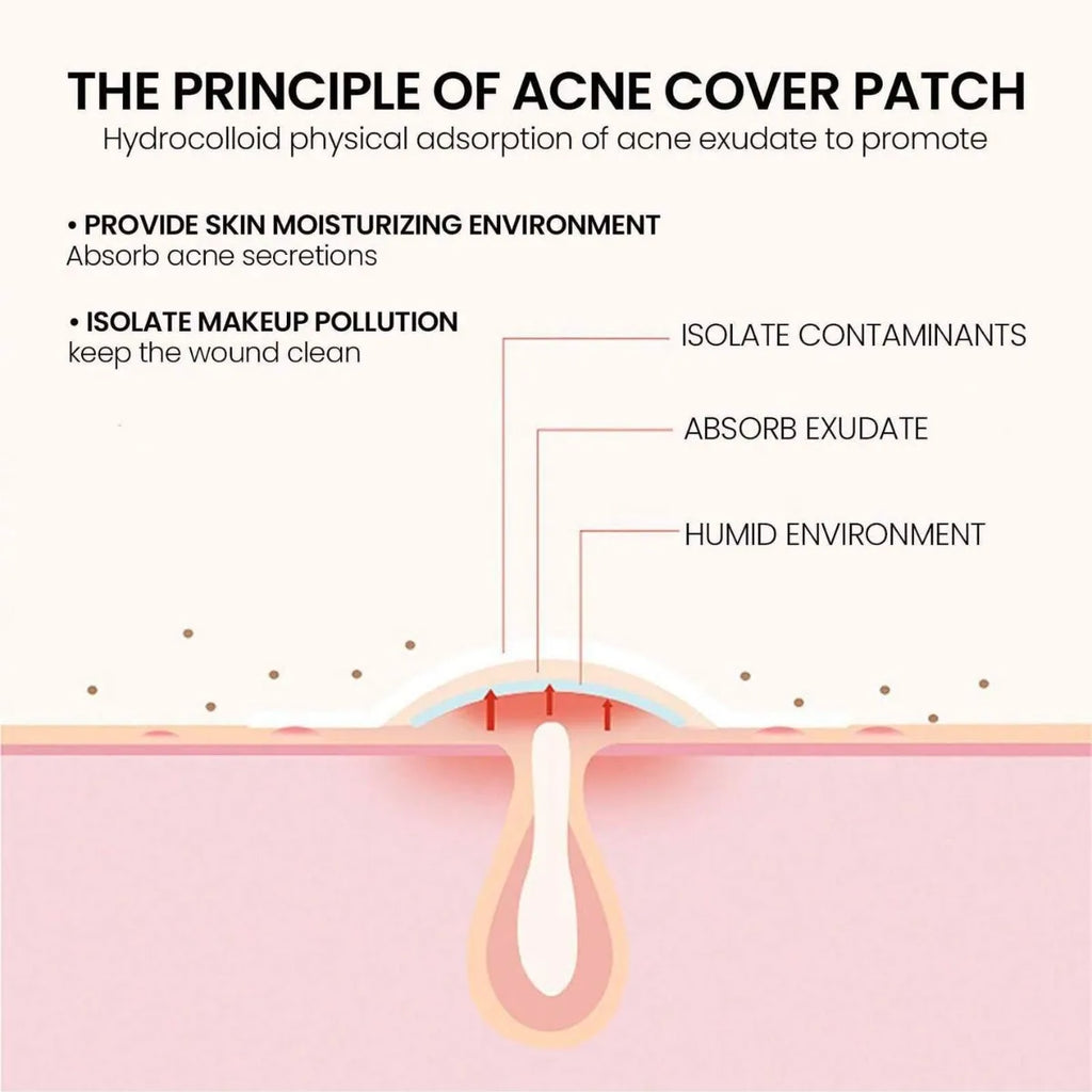 200pcs Star Acne Patch Facial Skin Care Fade Blemishes Pimple Marks Closed Acne Blemishes Cover Acne Pimple Repair Patch Oasis Select