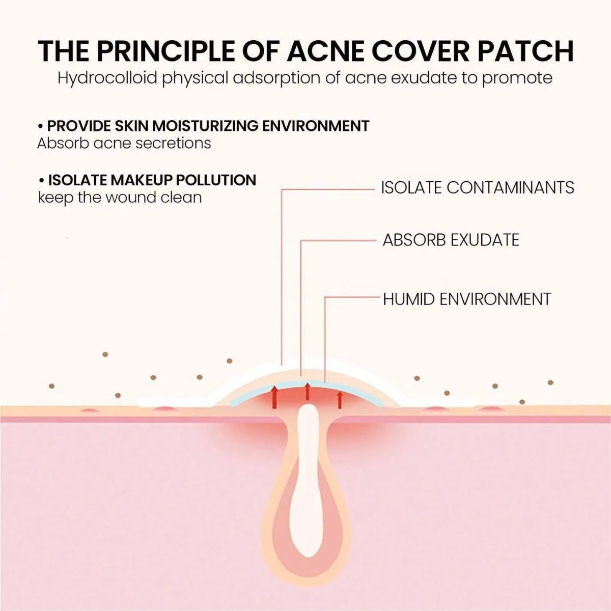 200pcs Star Acne Patch Facial Skin Care Fade Blemishes Pimple Marks Closed Acne Blemishes Cover Acne Pimple Repair Patch Oasis Select