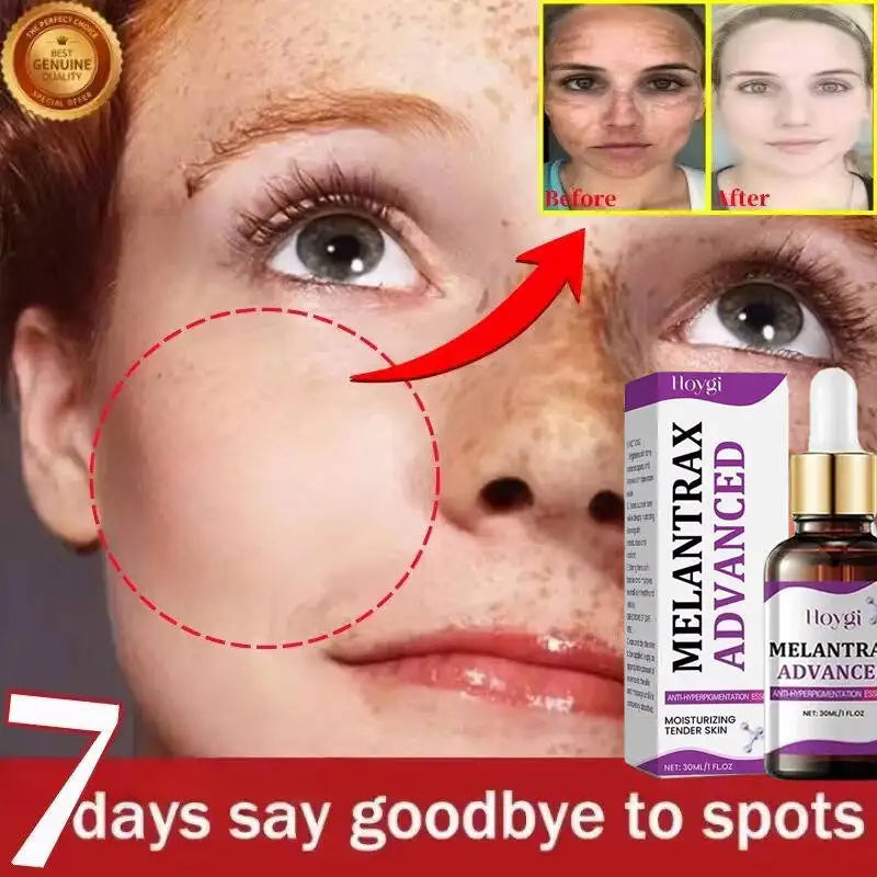 Hoygi Niacinamide Facial Serum Vitamin B3 Wrinkles Pigment Dark Spot Removal Correcting Glow Serum Face Whitening Moisturizer Oasis Select