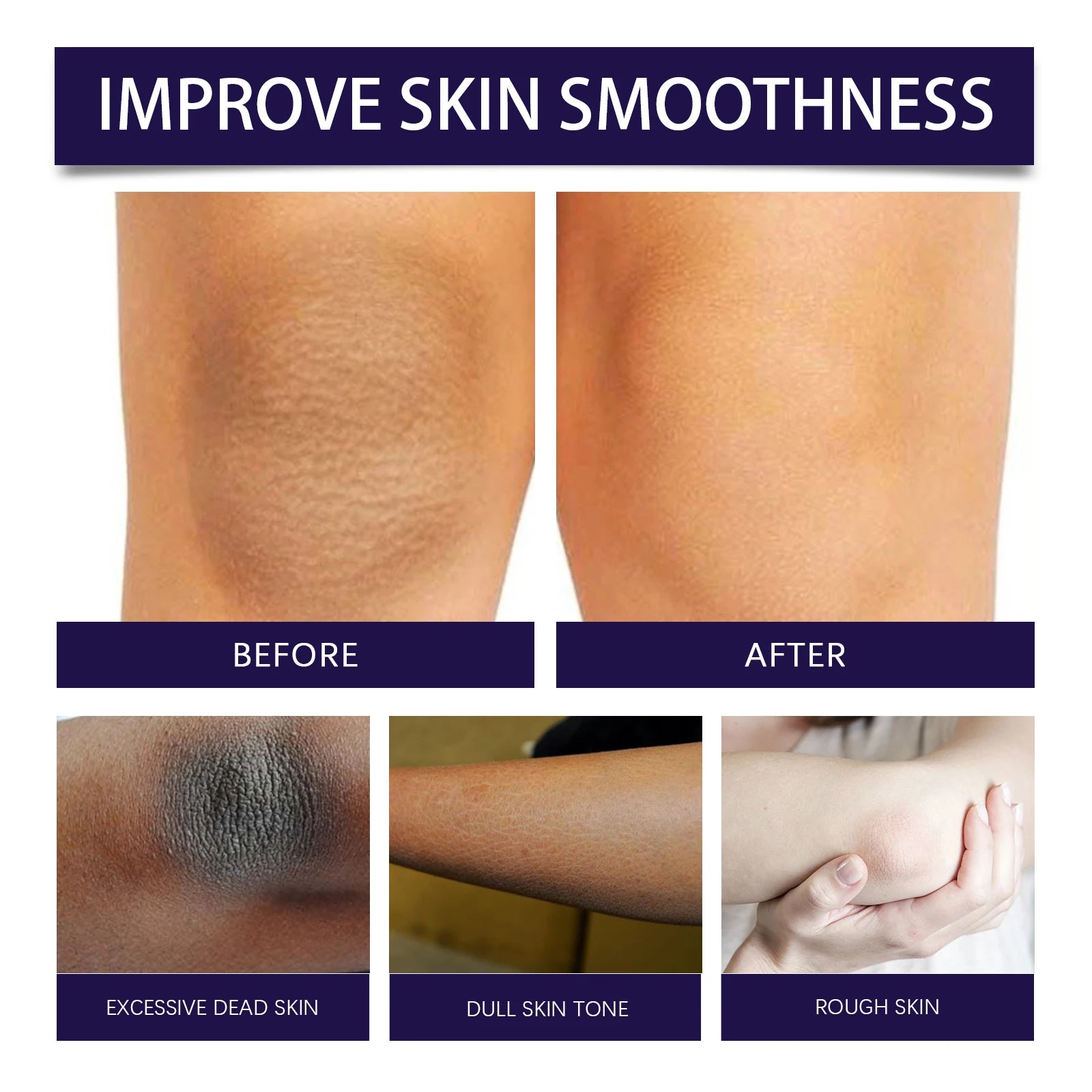 Body Scrub Effectively Removes Dead Skin Restores Smooth Delicate Skin Deep Moisturizing Exfoliating kin Brightening Remove Oasis Select