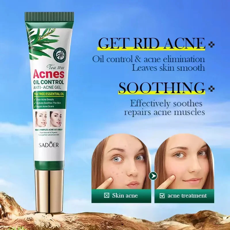 Tea Tree Facial Gel Cream – Oil Control & Blemish Care