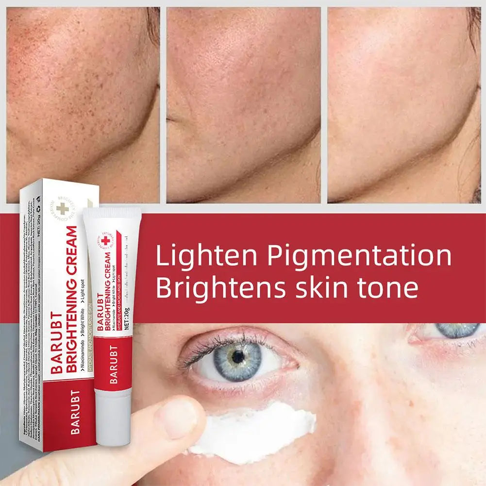 Whitening Freckles Face Cream Removal Melasma Dark Spots Corrector Lighten Melanin Pigmentation Brighten Beauty Care Oasis Select