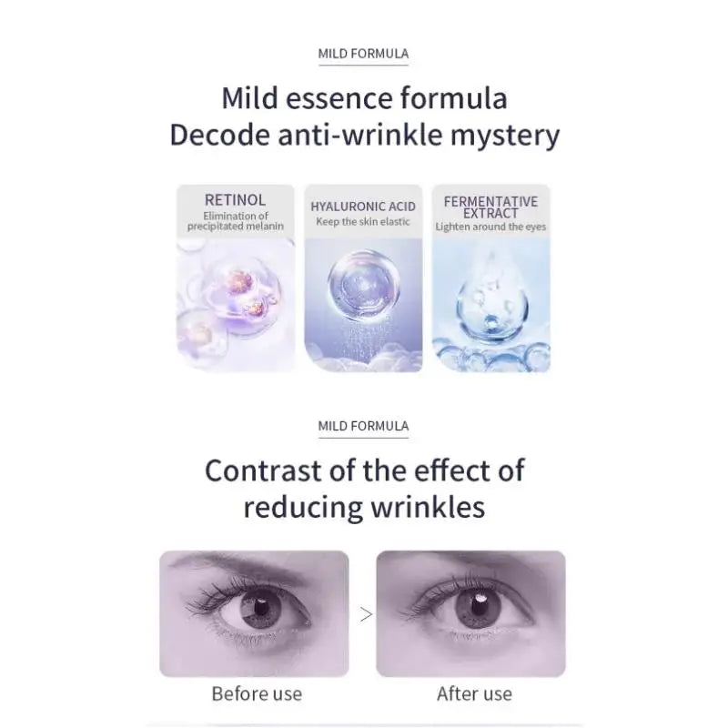 Hyaluronic Acid Eye Cream Roller For Wrinkles Dark Circles Puffiness Anti Aging Treatment Moisturizer Skin Care Oasis Select