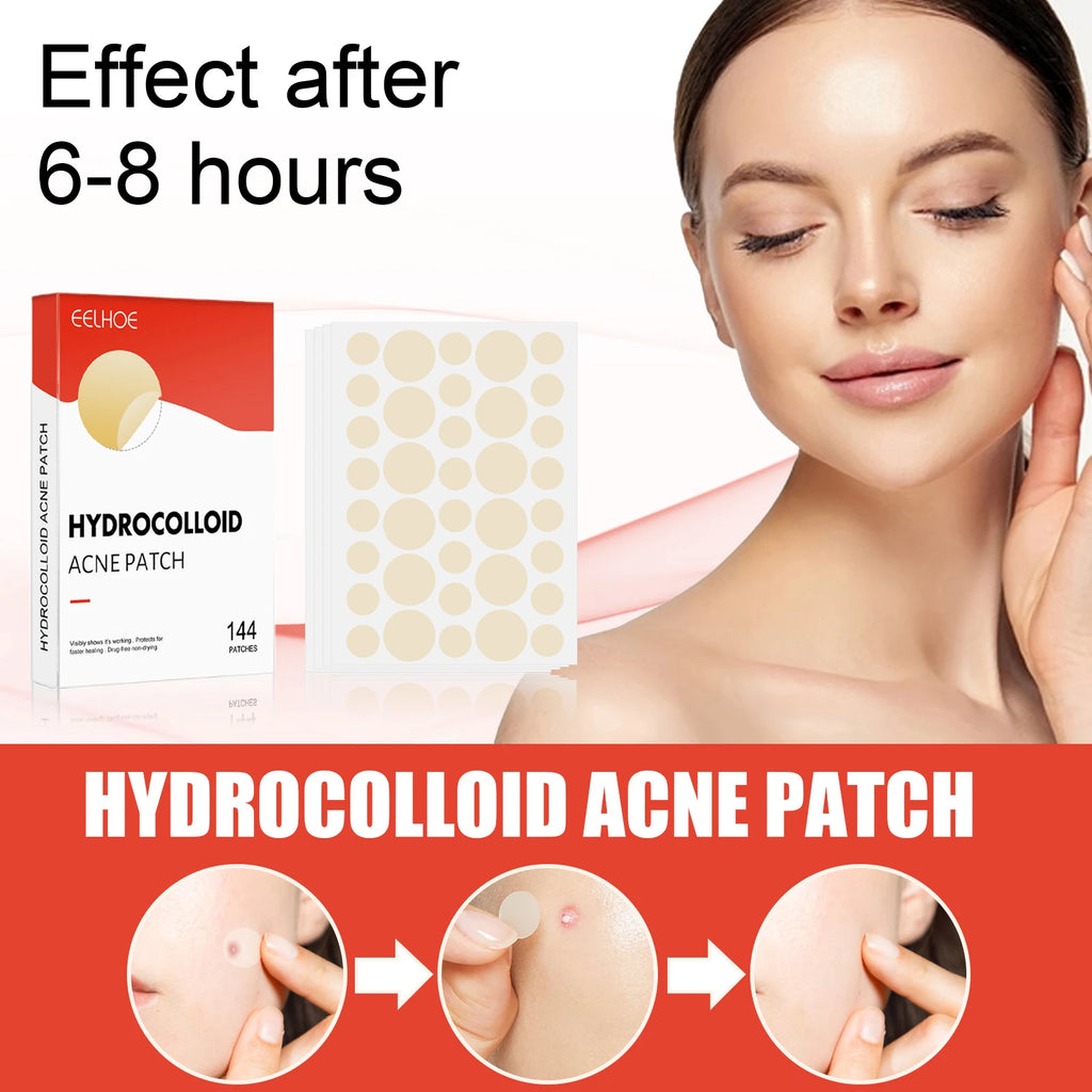 Hydrocolloid Acne Patches 144pc – 2 Sizes, Invisible & Clear Acne Patch Oasis Select