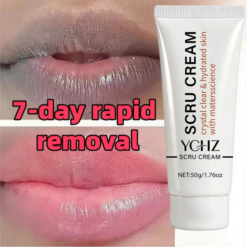 Whitening Lip Exfoliating Gel – Brightens, Smooths & Nourishes