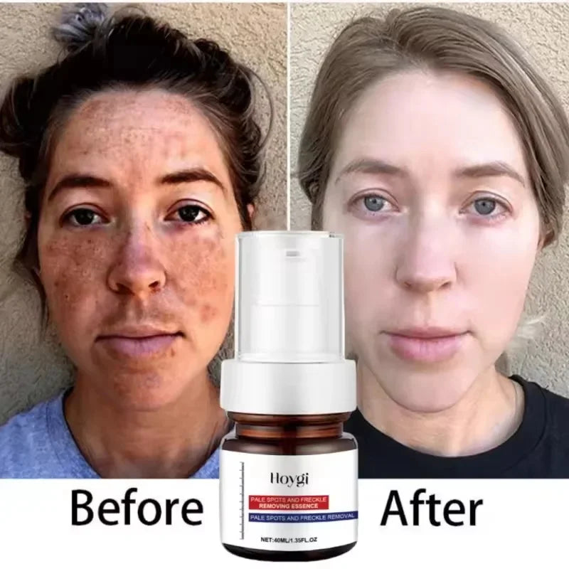 Collagen Face Serum & Cream Set – Firming & Brightening