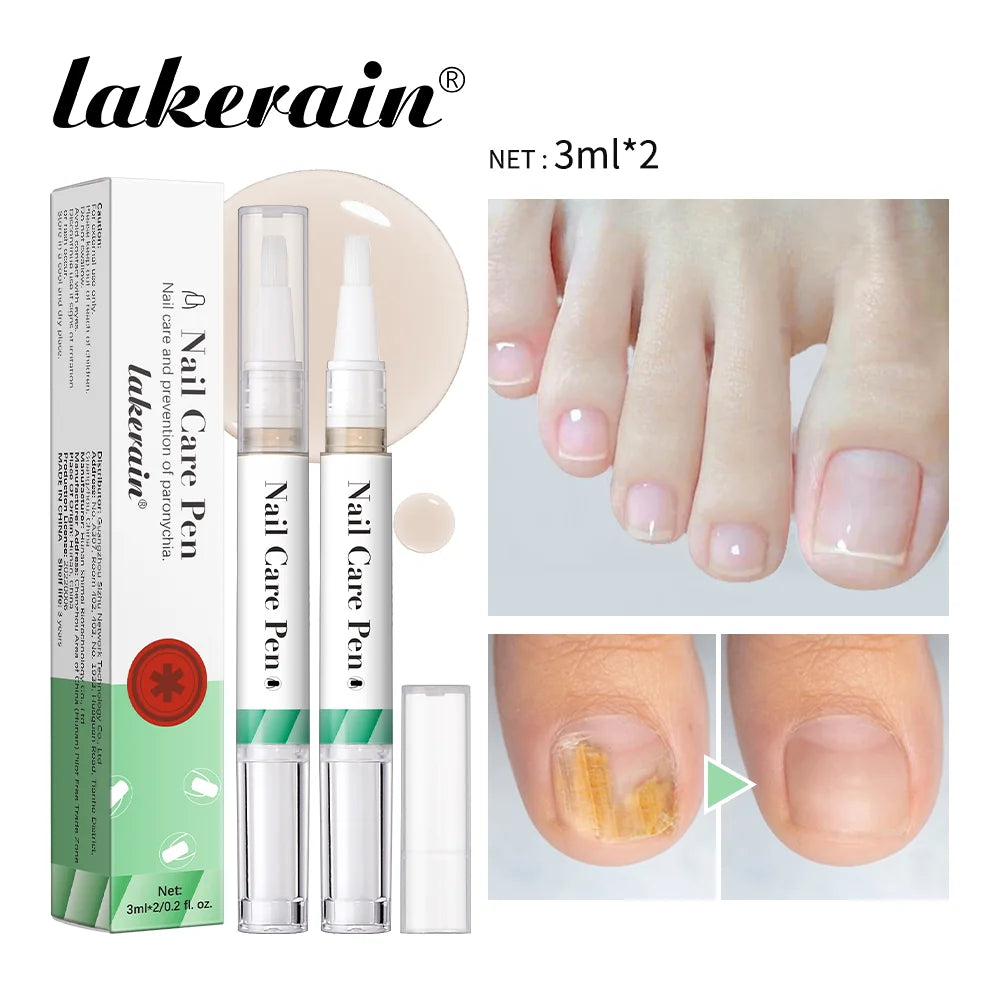 Nail Care Pen Nourish and Moisturize Nails Prevent Fungal Infections Improve Appearance Flat Brush Head Design Daily Nail Care Oasis Select Green x 2
