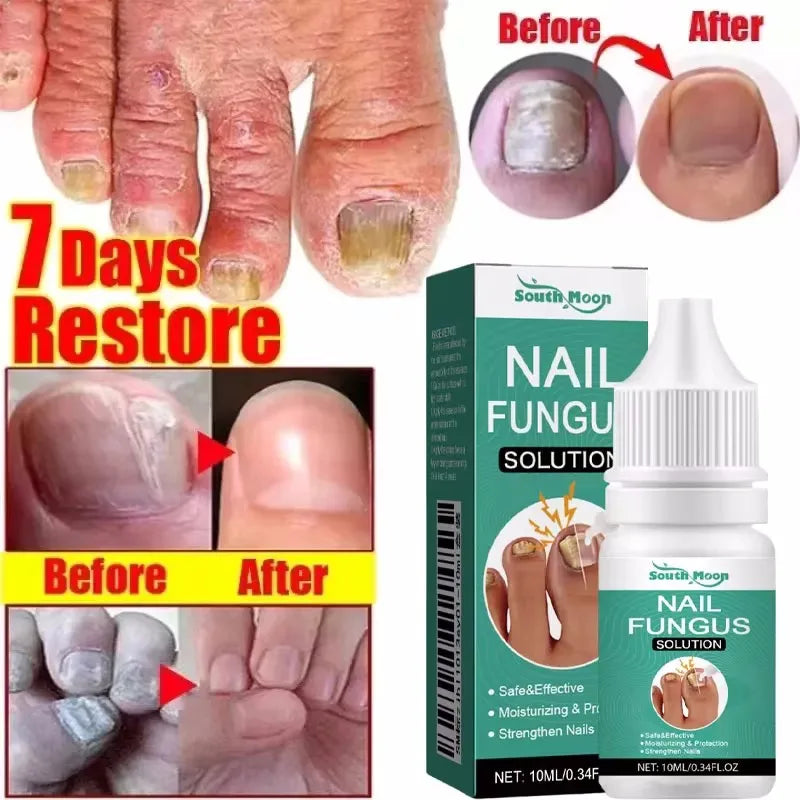 Eelhoe Nail Repair Serum – Ginger Extract for Healthy Nails Nail Repair Serum Oasis Select 1PCS