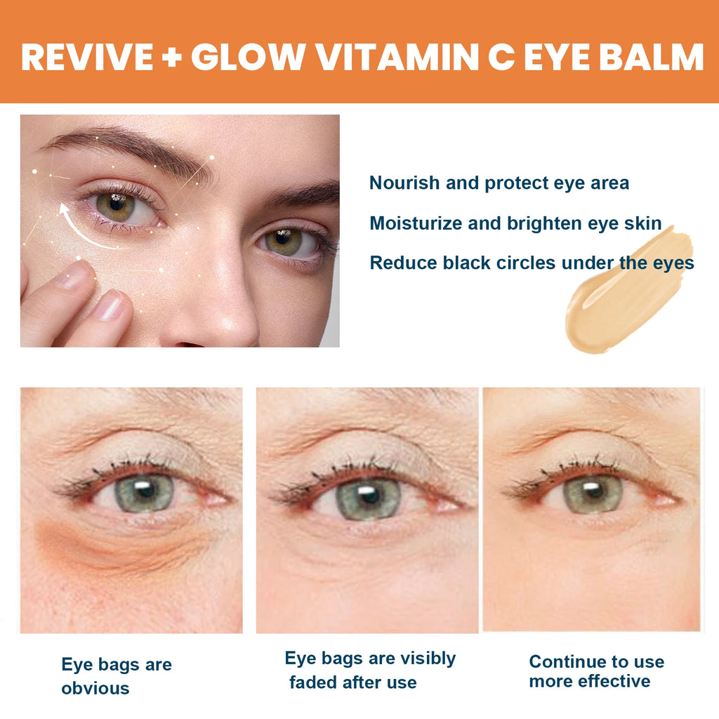 Vitamin C Eye Balm Moisturizing Eye Bag Removal Dark Circles Reduce Fine Lines Anti Puffiness Brightening Eye Cream Stick Oasis Select
